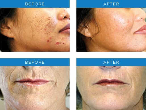 1764729291_profractional Profractional