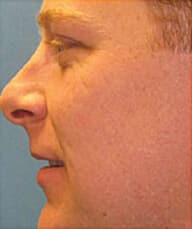 1764729305_Layer-93 Profractional