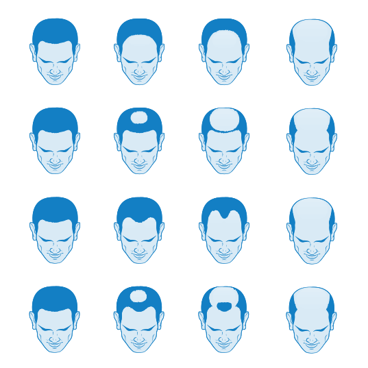 1764729665_Vector-Smart-Object Men’s Hair Replacement